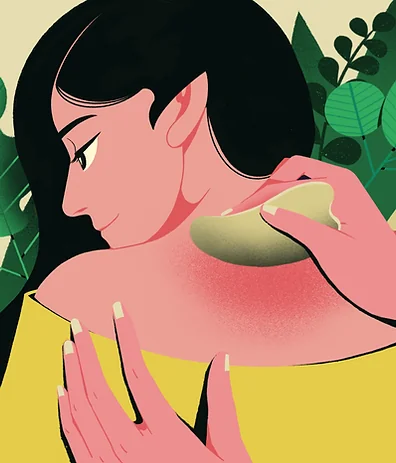 Gua Sha treatment at Fabi Acupuncture in Didcot, Oxfordshire